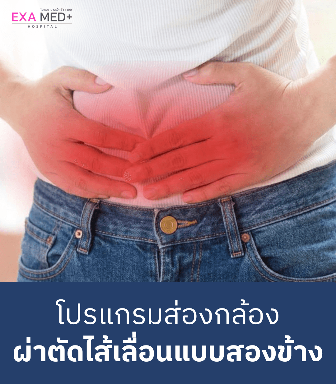 ผ่าตัดไส้เลื่อนสองข้าง